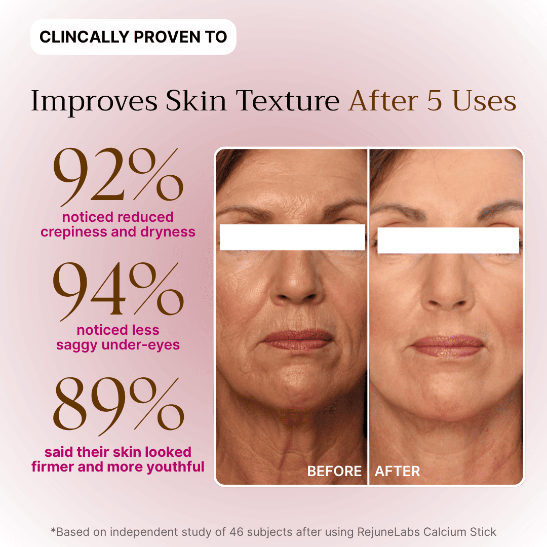 Anti Wrinkle Calcium Balm