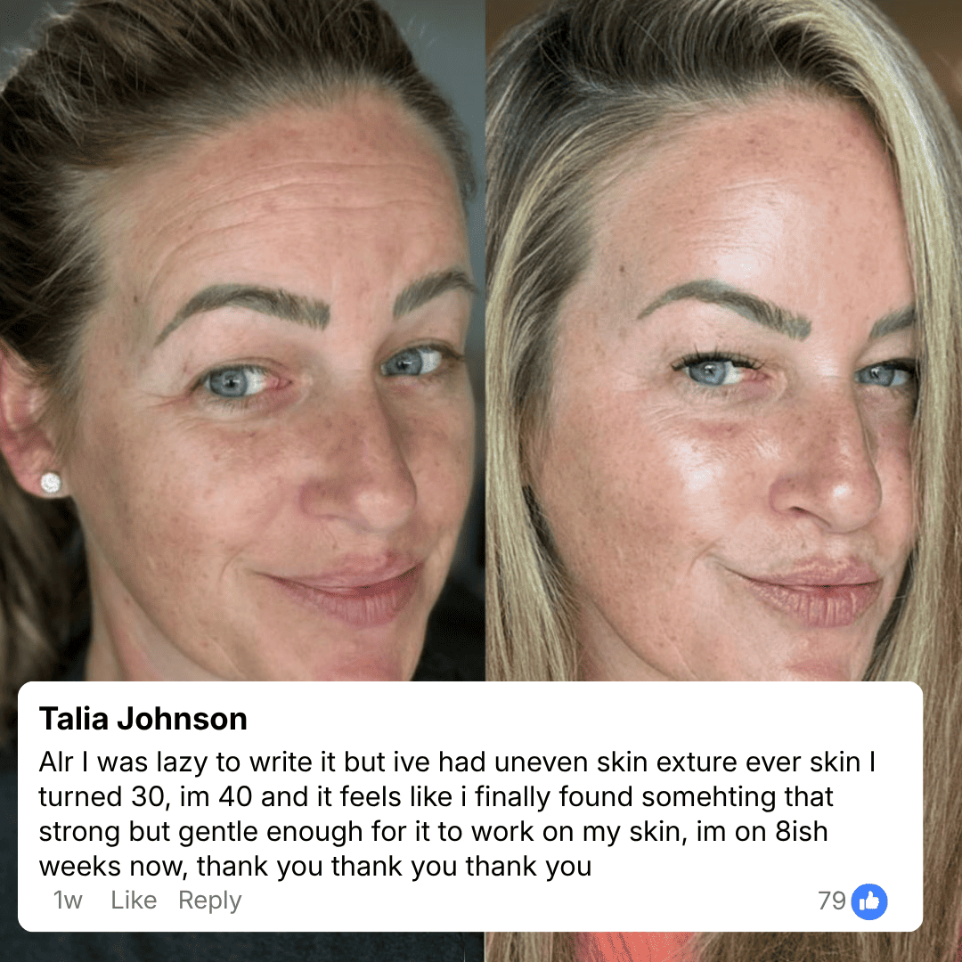 Anti Wrinkle Calcium Balm
