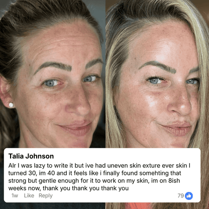 Anti Wrinkle Calcium Balm