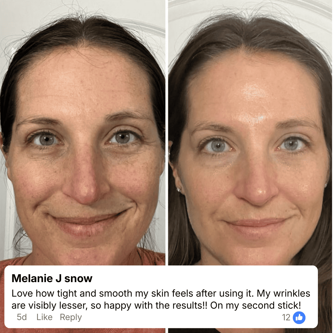 Anti Wrinkle Calcium Balm