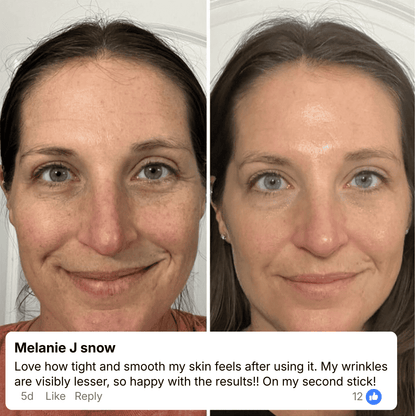Anti Wrinkle Calcium Balm